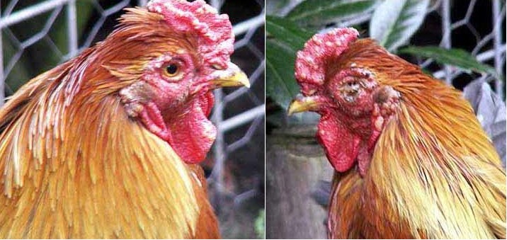 Bệnh thủy đậu và cách phòng ngừa và điều trị
